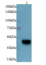Anti Desmin polyclonal antibody