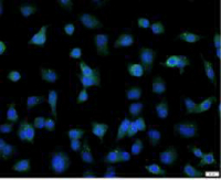 Anti ADAM10 polyclonal antibody