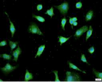 Anti DKK1 polyclonal antibody