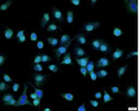 Anti CDKN1A polyclonal antibody