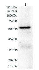 Anti GAD65 polyclonal antibody