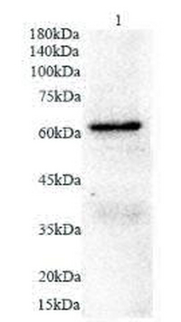 Anti GAD65 polyclonal antibody
