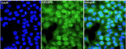 Anti SREBP1 polyclonal antibody