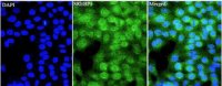 Anti SREBP1 polyclonal antibody