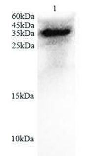 Anti IL6 polyclonal antibody