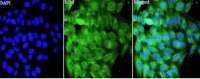Anti B2M polyclonal antibody