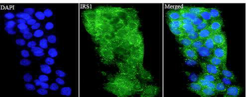 Anti IRS1 polyclonal antibody