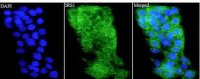 Anti IRS1 polyclonal antibody