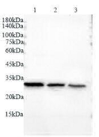 Anti LDHA polyclonal antibody