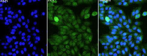 Anti CALCR polyclonal antibody