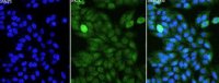 Anti CALCR polyclonal antibody