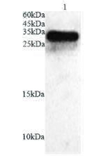 Anti ICOS polyclonal antibody