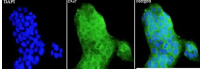 Anti EGF polyclonal antibody