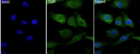 Anti PEDF polyclonal antibody