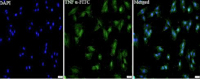 Anti TNFa polyclonal antibody