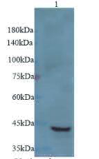 Anti RRM2B polyclonal antibody
