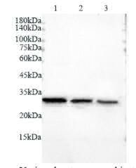 Anti LDHA polyclonal antibody