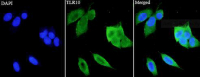 Anti TLR10 polyclonal antibody