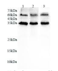 Anti CD16b polyclonal antibody