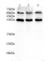Anti CD16b polyclonal antibody