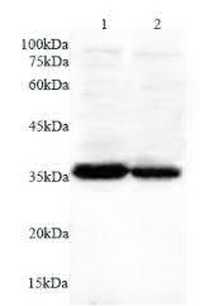 Anti ANXA5 polyclonal antibody
