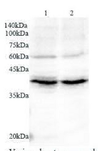 Anti a1AGP polyclonal antibody