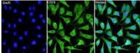Anti CD1b polyclonal antibody