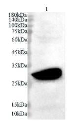 Anti OTUB2 polyclonal antibody