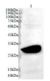 Anti OTUB2 polyclonal antibody