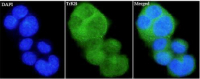 Anti TrKB polyclonal antibody