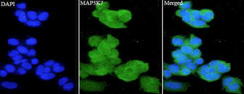Anti MAP3K7 polyclonal antibody