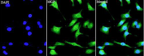 Anti MGP polyclonal antibody