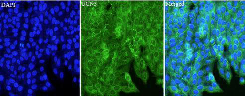 Anti UCN3 polyclonal antibody