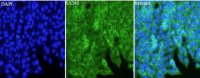 Anti UCN3 polyclonal antibody