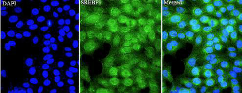 Anti SREBP1 polyclonal antibody