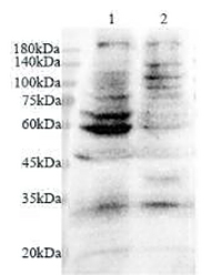 Anti Podocan polyclonal antibody
