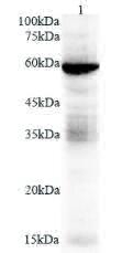 Anti TMPRSS2 polyclonal antibody