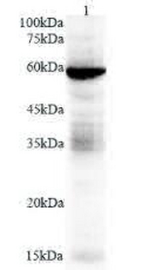 Anti TMPRSS2 polyclonal antibody