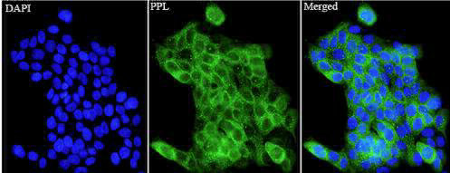 Anti PPL polyclonal antibody