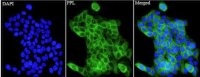 Anti PPL polyclonal antibody