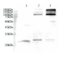 Anti GSTM2 polyclonal antibody