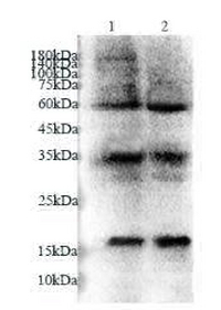 Anti UBC9 polyclonal antibody