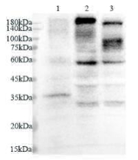 Anti FGFR1 polyclonal antibody