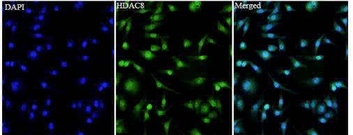 Anti HDAC8 polyclonal antibody