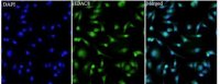 Anti HDAC8 polyclonal antibody