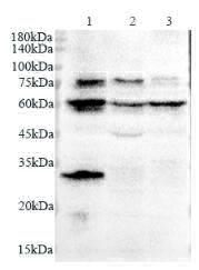 Anti S6K polyclonal antibody