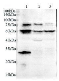 Anti S6K polyclonal antibody