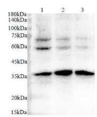 Anti CDK6 polyclonal antibody