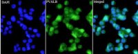 Anti PVALB polyclonal antibody