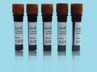 MMP2 mouse Monoclonal Antibody(1H1)